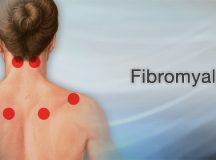 Fibromyalgia: A titokzatos betegség (1. rész)